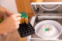 запазване на стволови клетки - 70045 предложения