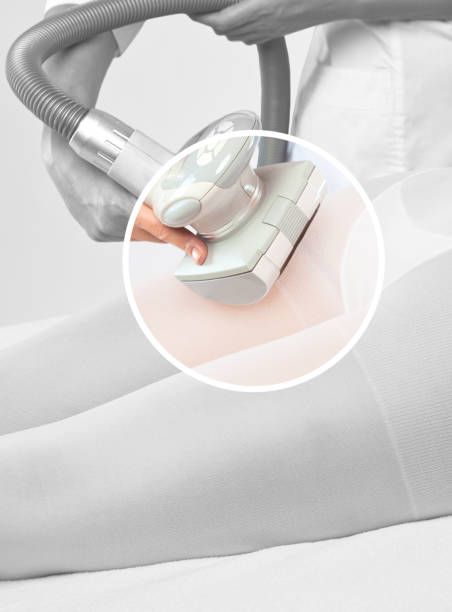 антицелулитни процедури - 79331 типа