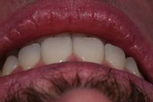 дентална клиника софия - 95367 възможности