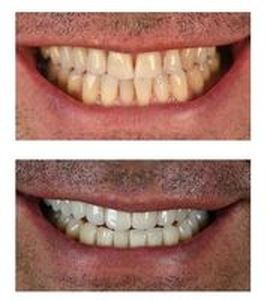 зъбни импланти - 35214 награди